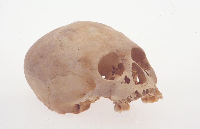 Skull of child recovered from the Lucayan Caverns in September 1973.